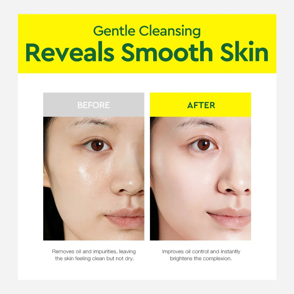 Before-and-after skincare comparison graphic showing a woman's face with glossy, oil-rich skin on the left ('BEFORE') and smoother, clearer skin on the right ('AFTER'). Large text at the top reads 'Gentle Cleansing Reveals Smooth Skin' on a bright yellow background.