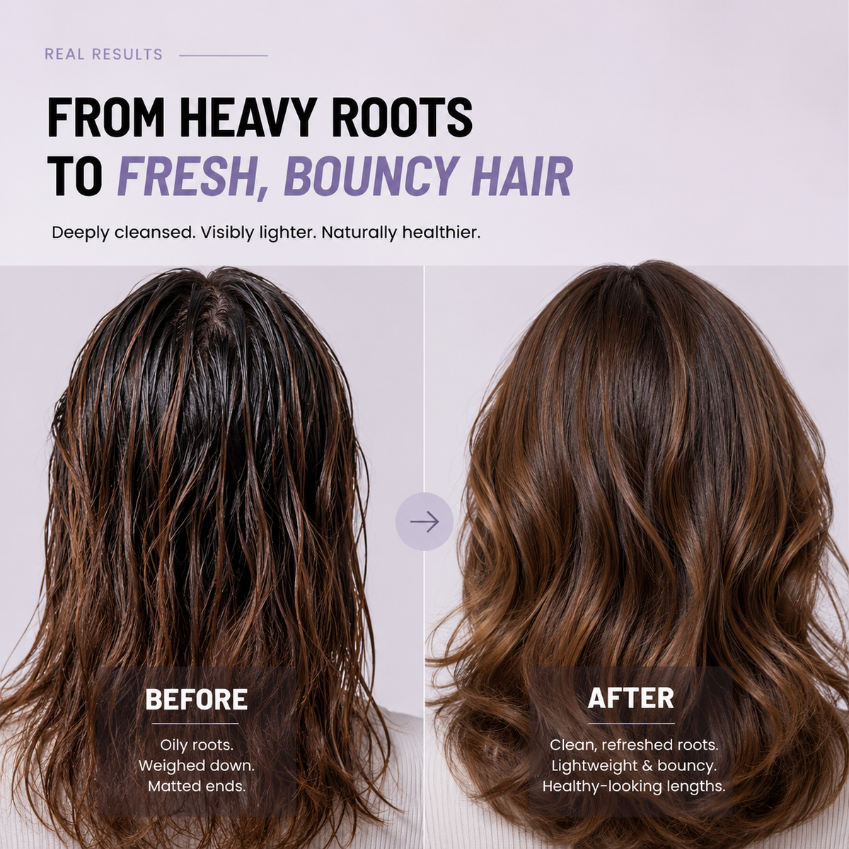 MATSU Extension Hair Shampoo for Fast Hair Growth & Sebum Balancing
