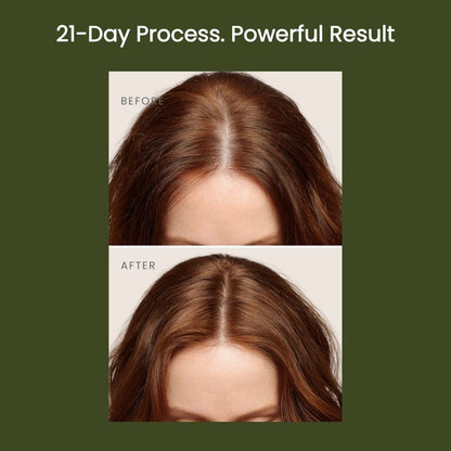 Scalpify Pro-scalp therapy Anti-Hair Loss Scalp Serum 50 ml