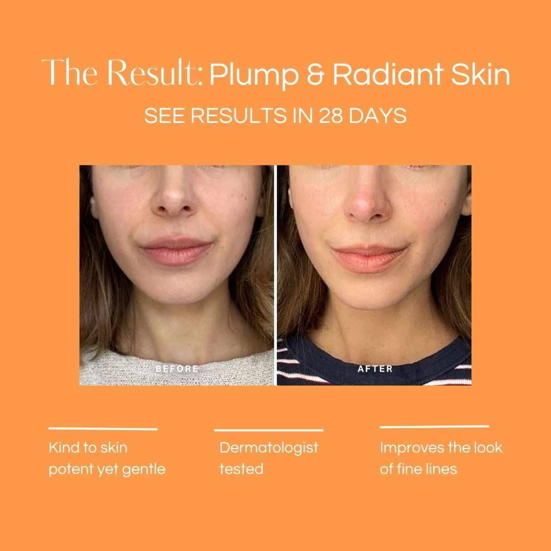KNOWN Vitamin C Lightening & Moisturising Serum