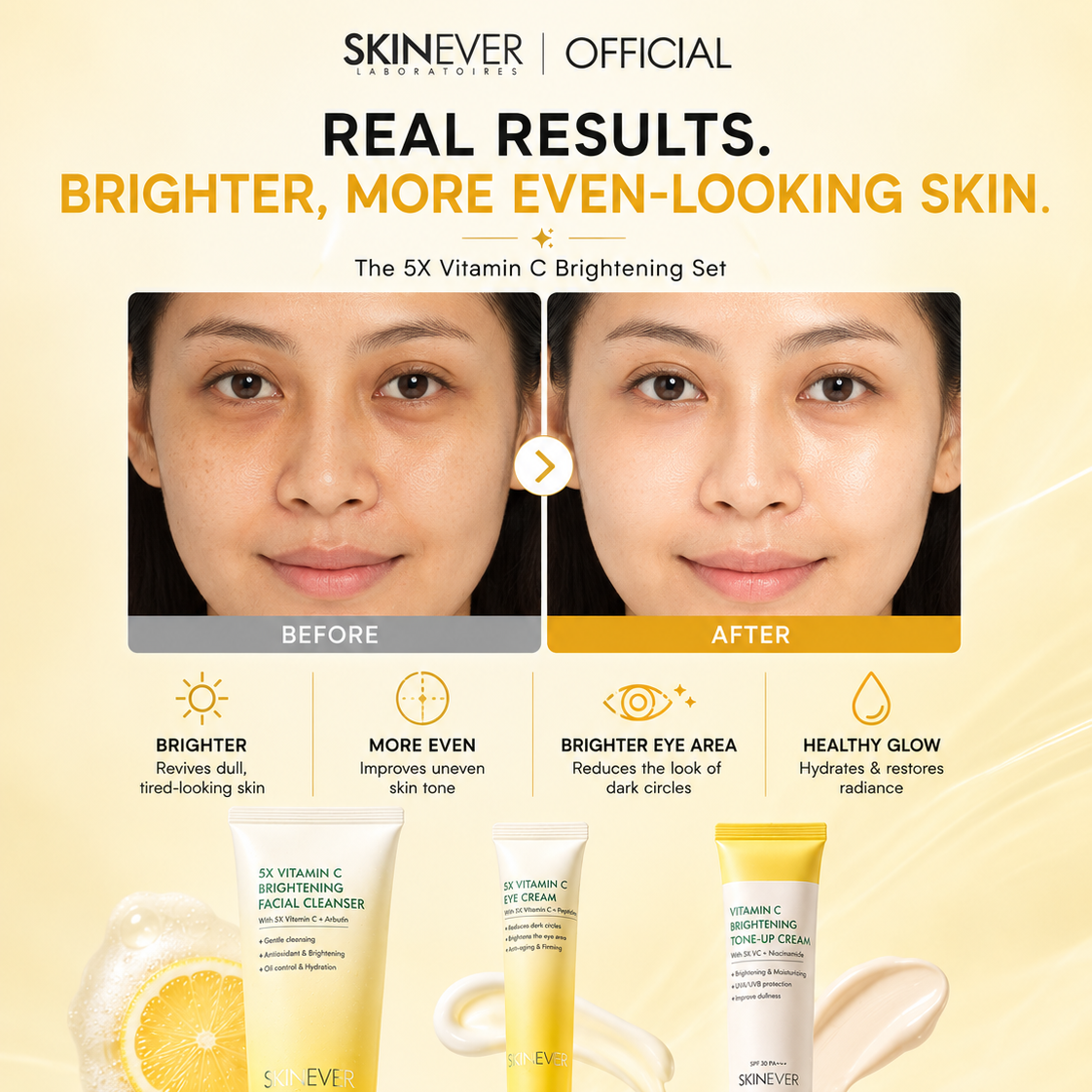 5X Vitamin C Brightening Set - Cleanser, Eyecream, Tone up SPF Cream