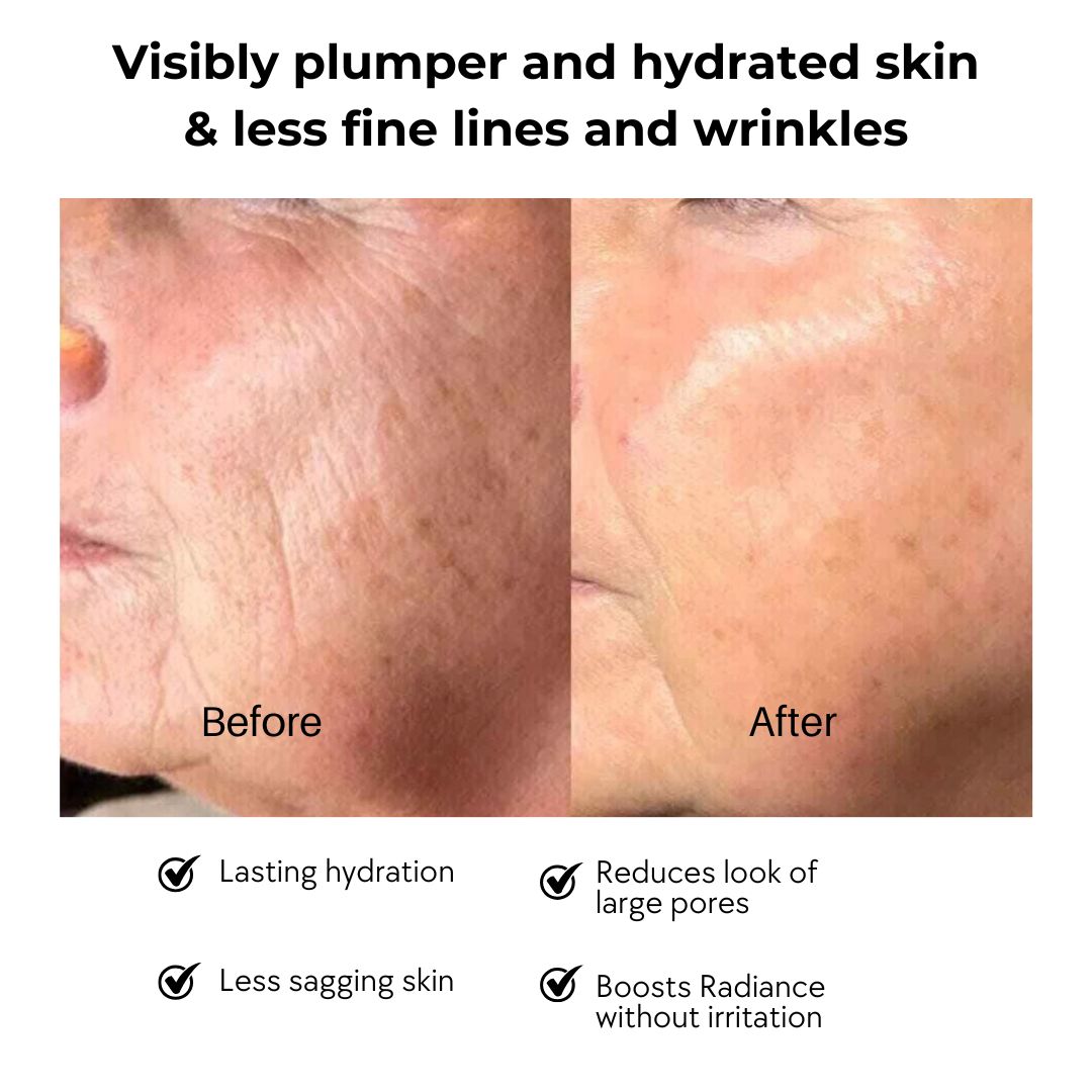 The Radiance Bundle - Dermaculpt Device +Known Serums