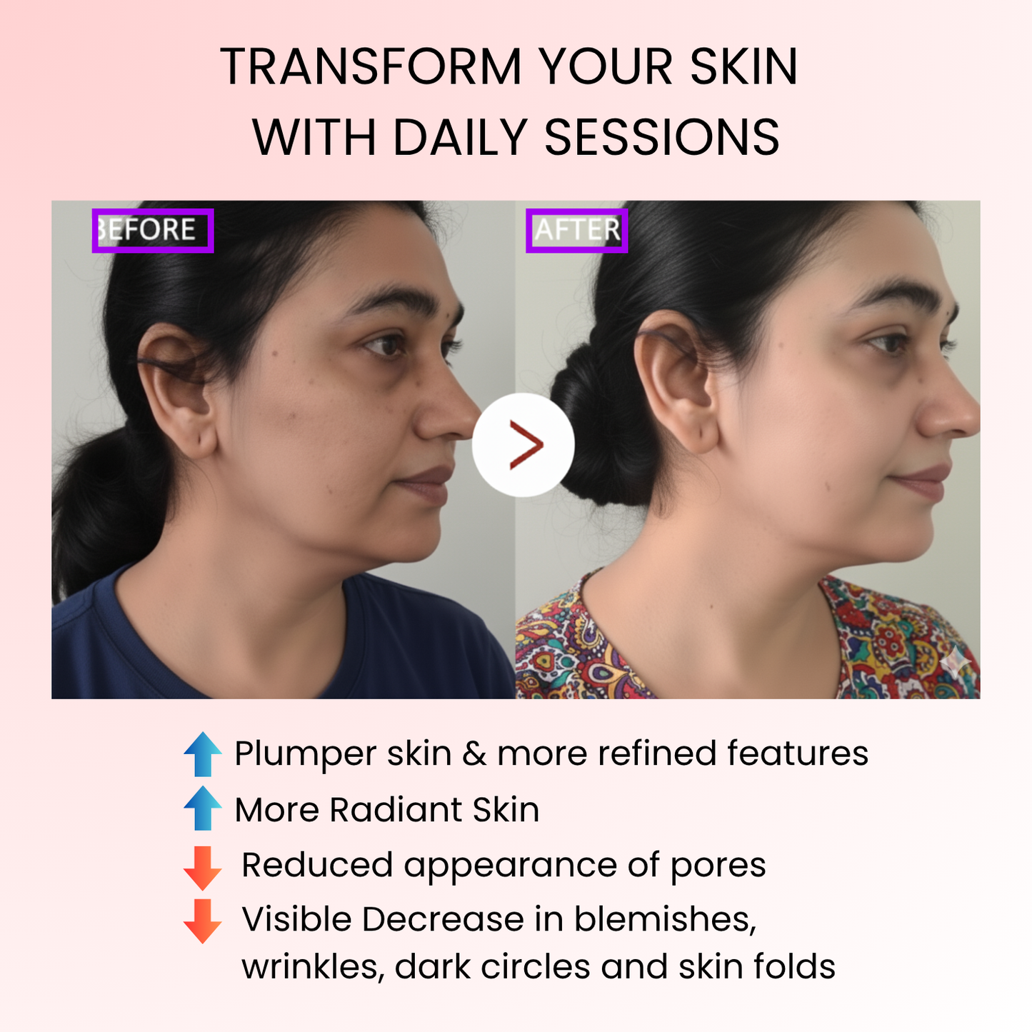 DermaSculpt™ EMS Facial Treatment Device