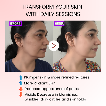 DermaSculpt™ EMS Facial Treatment Device