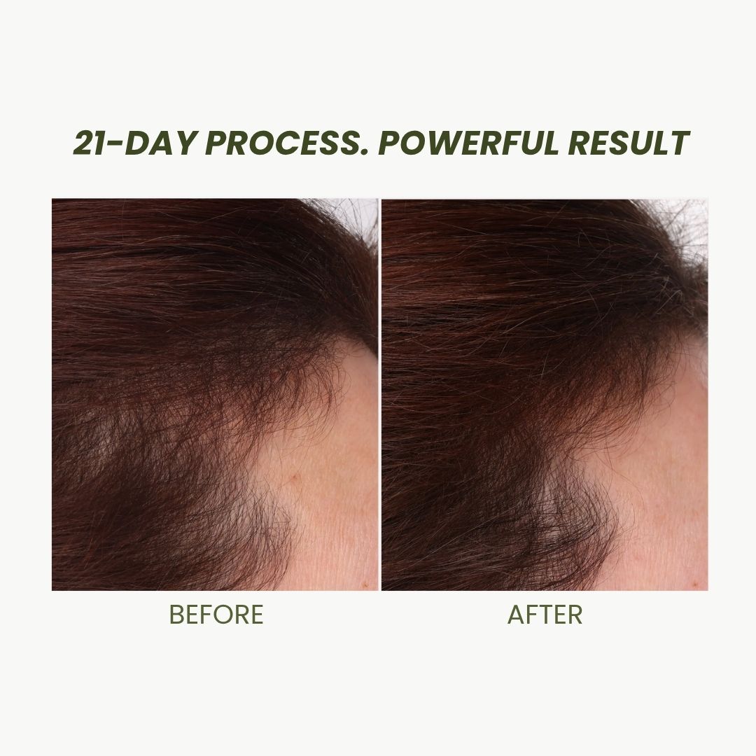 Scalpify  Pro-scalp therapy Biotin Anti-Hair Loss Shampoo 350 ml