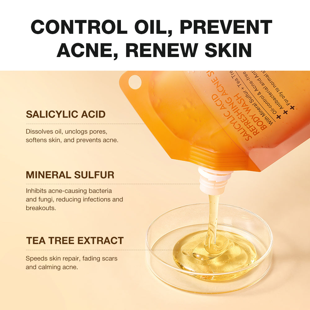 SKINEVER Acne Clearing Body Wash