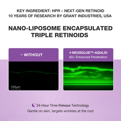 Advertisement for nano-liposome encapsulated triple retinoids with enhanced penetration technology.