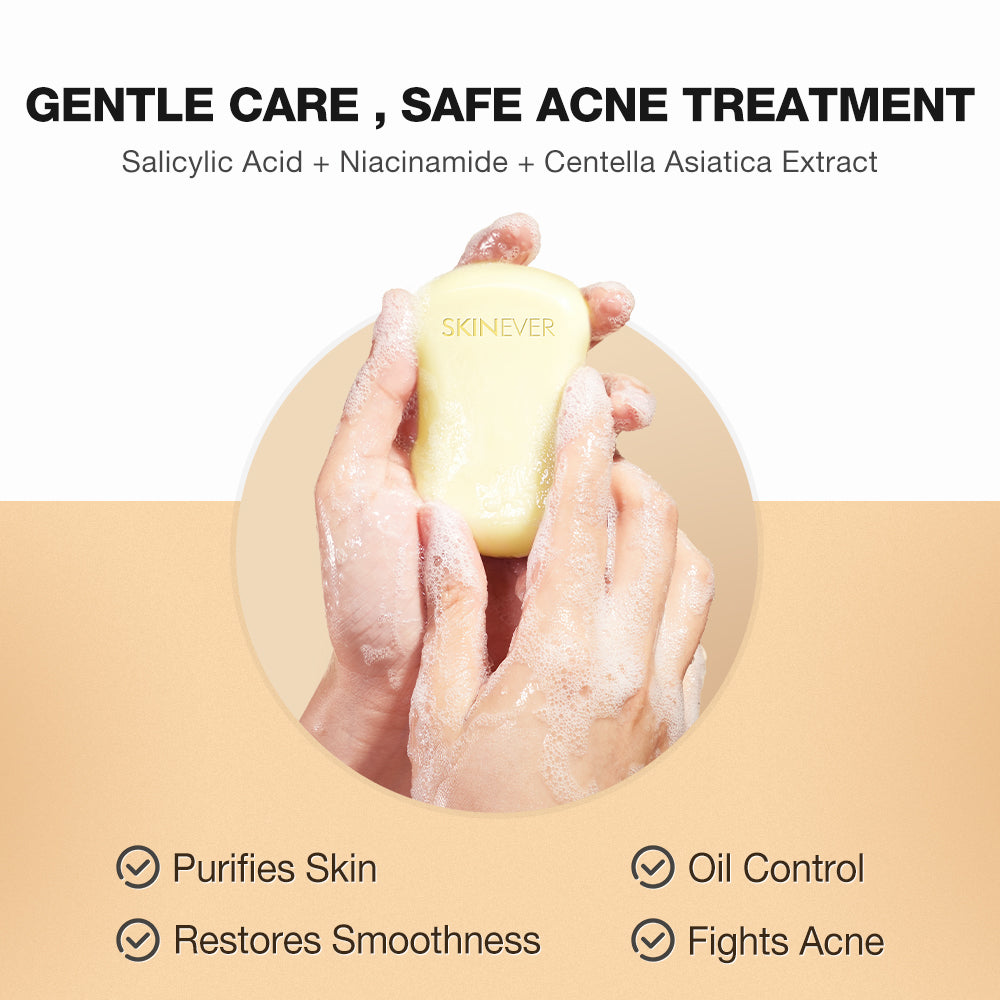 Salicylic Acid Oil Control Acne Cleansing Soap