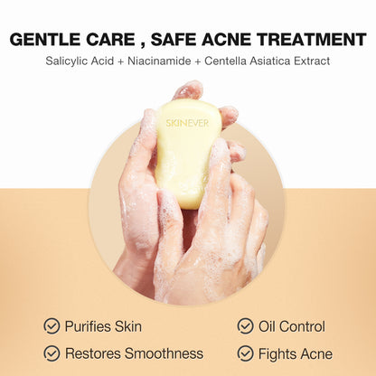 Salicylic Acid Oil Control Acne Cleansing Soap