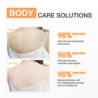 Weightless Body Lotion - Salicylic Acid, Vitamin E, Centella
