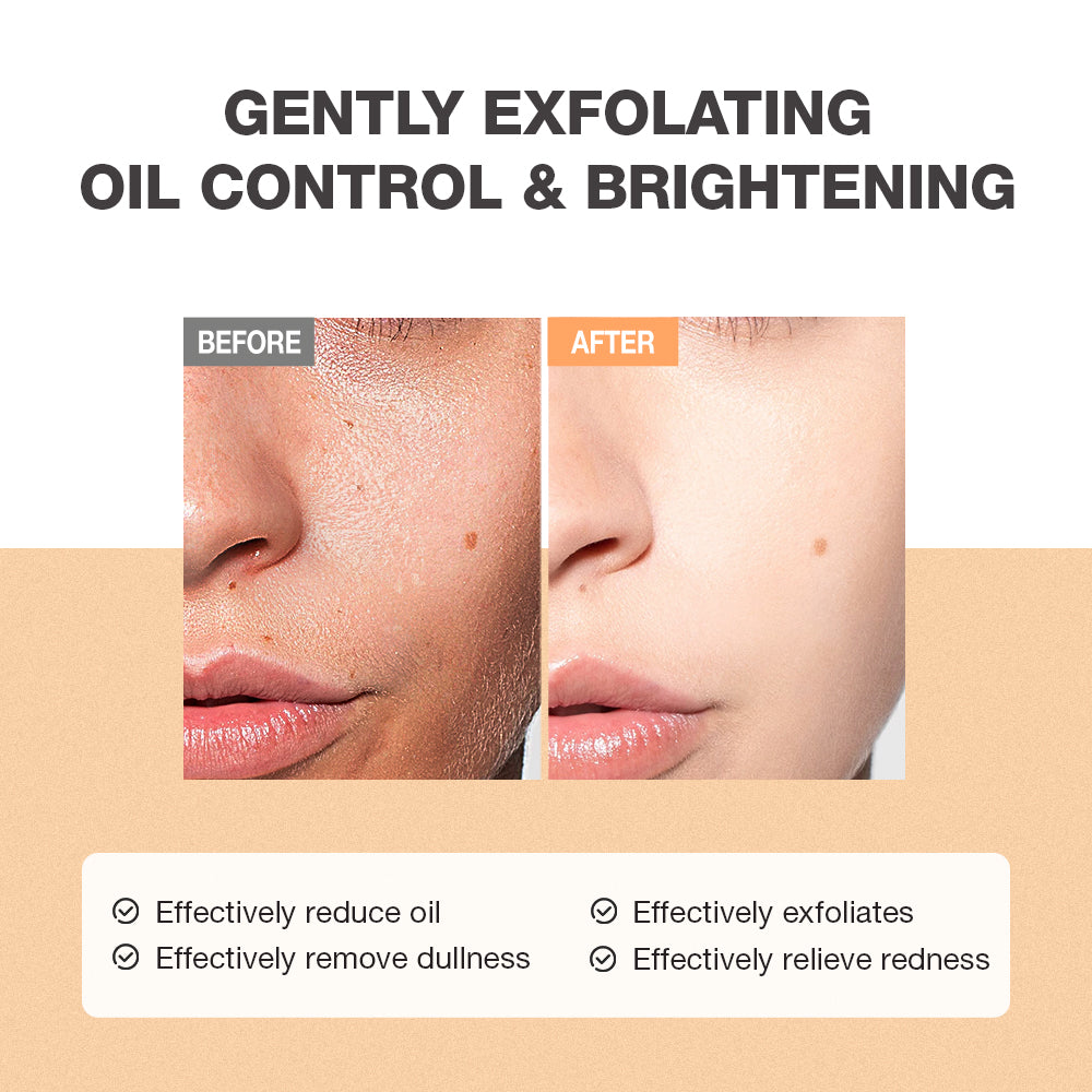 SKINEVER Salicylic Acid Refreshing Scrub Cleanser