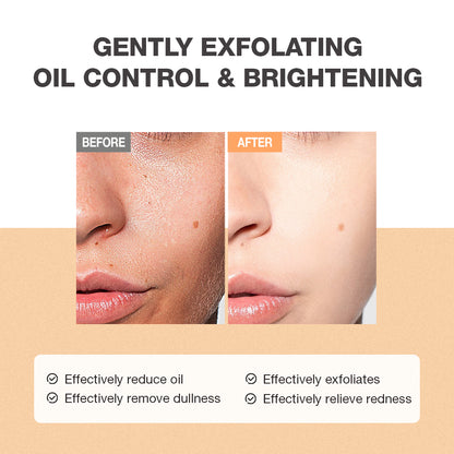 SKINEVER Salicylic Acid Refreshing Scrub Cleanser