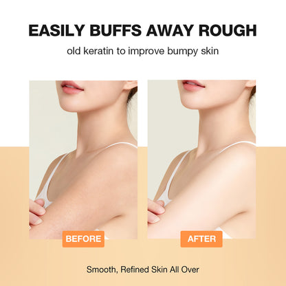 Salicylic Acid Fragrant Body Scrub