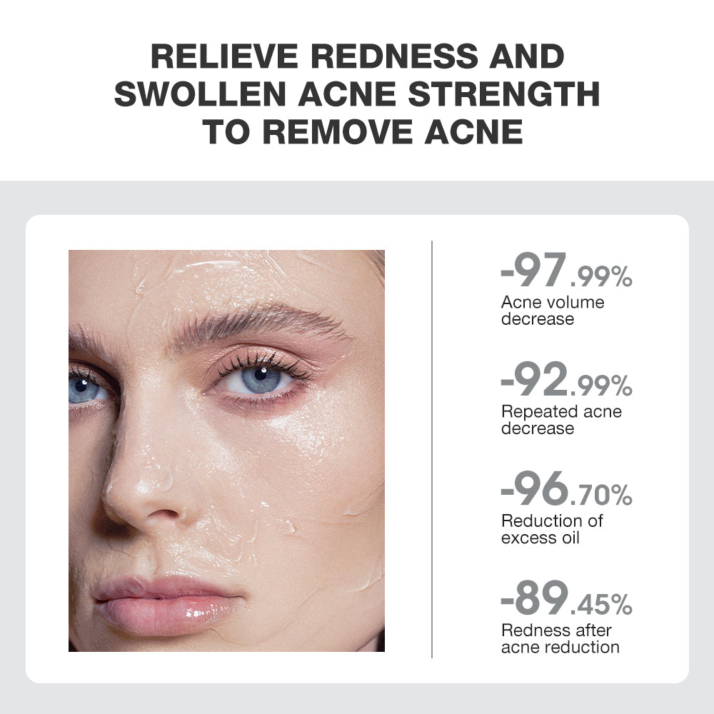 SKINEVER Acne Treatment Ice Sleep Masque
