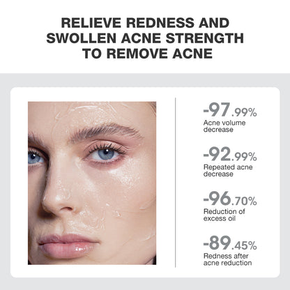 SKINEVER Acne Treatment Ice Sleep Masque