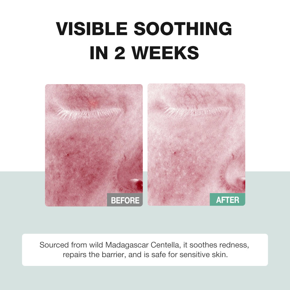 SKINEVER Centella Asiatica Soothing & Repair Serum