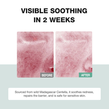 SKINEVER Centella Asiatica Soothing & Repair Serum