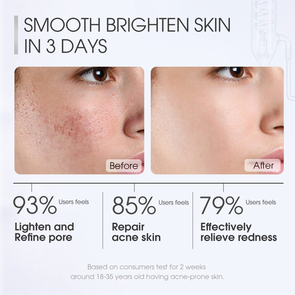 SKINEVER Salicylic Acid Deep Pore Cleansing Masque