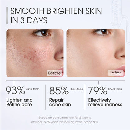 SKINEVER Salicylic Acid Deep Pore Cleansing Masque