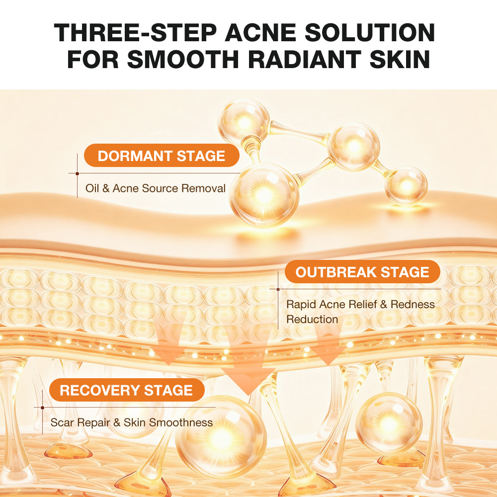 SKINEVER Acne Clearing Body Wash