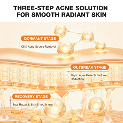SKINEVER Acne Clearing Body Wash
