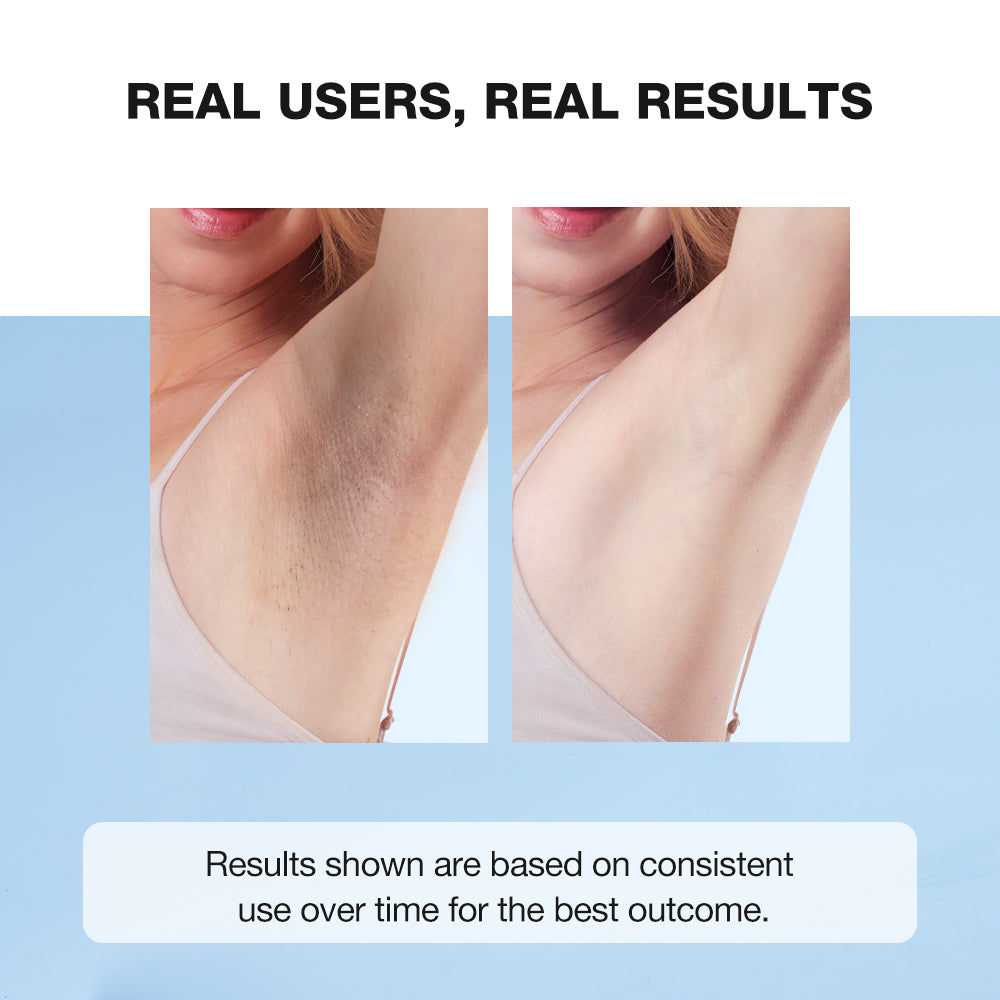 Deodorant Brightening Underarm Cream