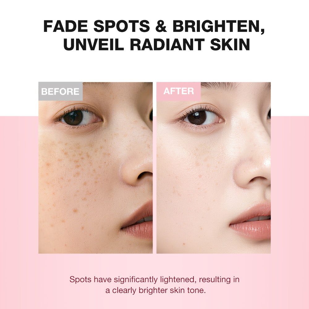 Dark Spot Brightening & Moisturising Set- Serum + Cream