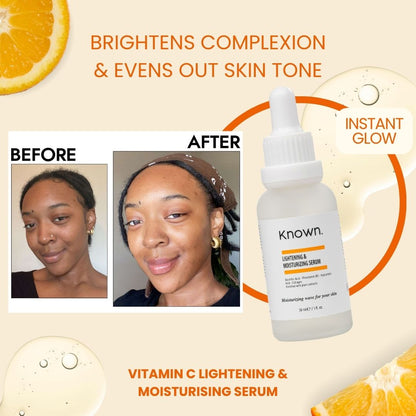 KNOWN Vitamin C Radiance Set- Serum, Toner, Moisturiser