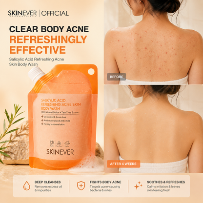 SKINEVER Acne Clearing Body Wash