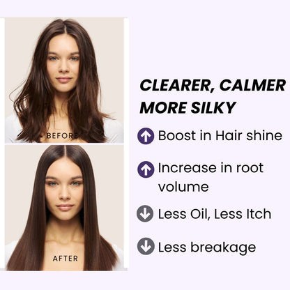 Detox & Hair Growth Treatment Duo- Mask + Shampoo